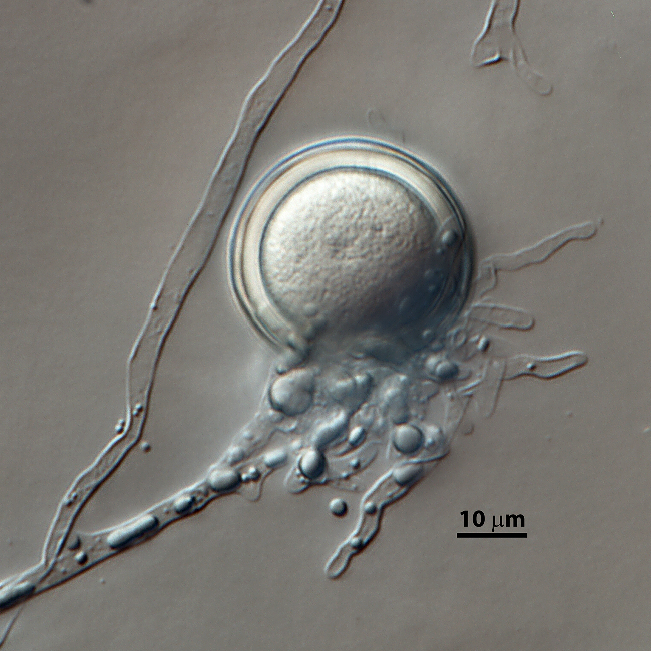   Phytophthora pseudosyringae nbsp;(ex-type CPHST BL 51G) sexual phase: slightly aplerotic oosporenbsp;with paragynous antheridium and knotted hyphae; photonbsp;by Vickie Brewster, USDA-APHIS-PPQ. 
